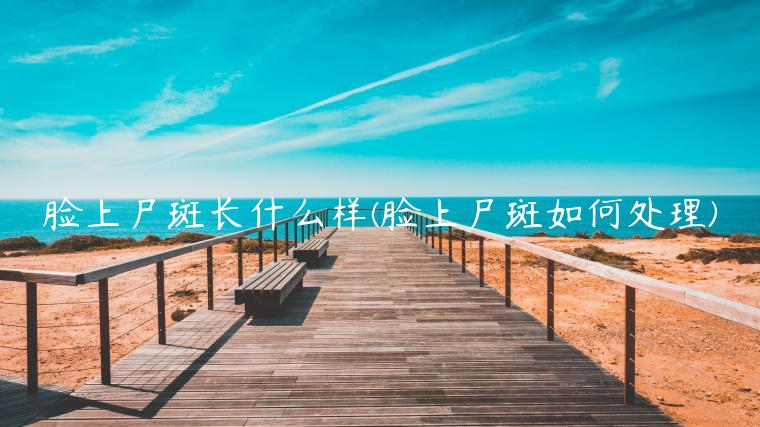 脸上尸斑长什么样(脸上尸斑如何处理)插图 脸上尸斑长什么样(脸上尸斑如何处理)