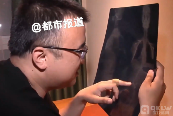 被骗缅北女孩常挺大肚子是真的吗