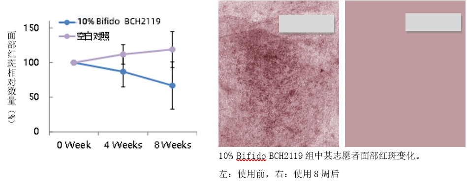 BCH2119二裂酵母发酵产物溶胞物6 BCH2119二裂酵母发酵产物溶胞物6